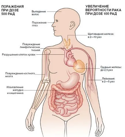 Radioaktív szennyeződés - a nukleáris világ