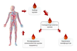 Tratamentul artritei reumatoide și prevenirea