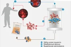 Rheumatoid arthritis kezelése és megelőzése