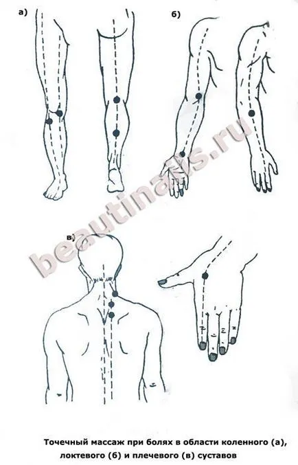 A reumatoid arthritis egy népszerű kezelés