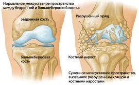 Кликнете на колянната става по време на ходене, разширение и флексия