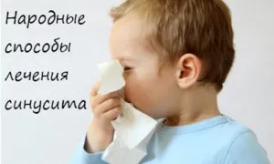 Як вилікувати синусит народними засобами (народними) Як вилікувати синусит народними засобами