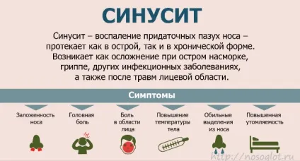 Як вилікувати синусит народними засобами (народними) Як вилікувати синусит народними засобами