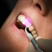 A modern módszerek a periodontitis kezelése egység „vektor”, Lézerterápiás