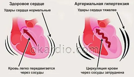 Spasm al vaselor periferice, în hipertensiunea arterială - stiri medicale