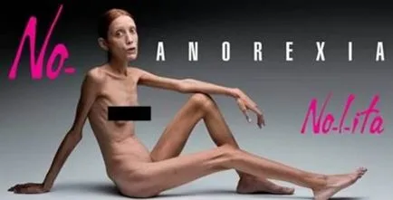 Szörnyű eset anorexia (10 fotó)