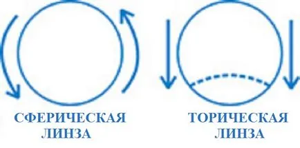 Tórikus kontaktlencse, azaz kiválasztása, és a legjobb nap