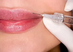Ajakfeltöltés Botox lehetséges következményeit az eljárás