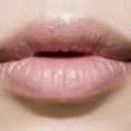 Як вивести герпес