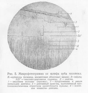 Як відновити емаль на зубах в домашніх умовах (емаль) Як відновити емаль на зубах в домашніх умовах