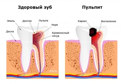 Як піклуватися про ваших зубах і яснах (жувальної гумки цукру) Як піклуватися про ваших зубах і яснах