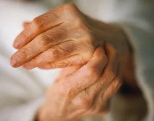 Възпаление на ставите в ръцете и краката причинява и лечение
