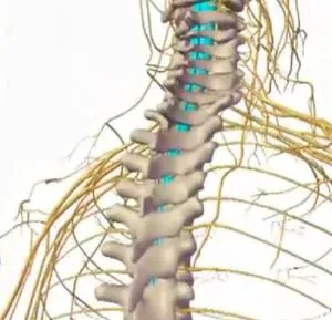 Inflamatia maduvei spinarii - simptome, diagnostic, tratament