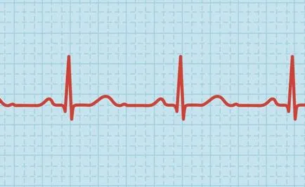 7 moduri de a incetini rapid ritmului cardiac