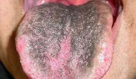 Черно кожа при възрастни причинява от тъмни и кафяви петна