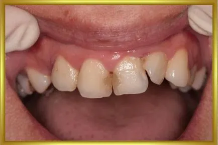 Dental-ревю, снимки, клиничен случай №24 избран клинични случаи