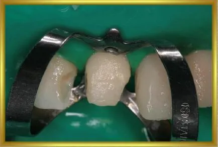 Dental-ревю, снимки, клиничен случай №24 избран клинични случаи