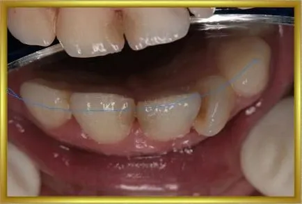 Dental-ревю, снимки, клиничен случай №24 избран клинични случаи