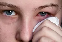 Катаракта операція, реабілітація в післяопераційний період, догляд і рекомендації (катаракта) Катаракта операція, реабілітація в післяопераційний період, догляд і рекомендації