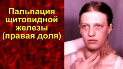 Кіста щитовидної залози у жінок - симптоми і лікування народними засобами (жінок) Кіста щитовидної залози у жінок - симптоми і лікування народними засобами