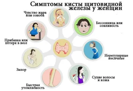 Кіста щитовидної залози у жінок - симптоми і лікування народними засобами (симптоми) Кіста щитовидної залози у жінок - симптоми і лікування народними засобами