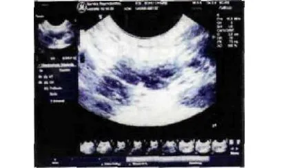 ultrasonografie ovarian la câini