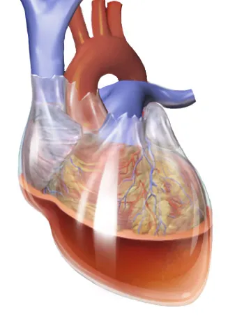 Hemopericardium (tamponada cardiaca) - cauze, tipuri, complicații, simptome, tratament hemopericardium