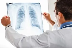 Rugalmas pulmonális tünetek kezelésére és népi jogorvoslat, diagnosztika