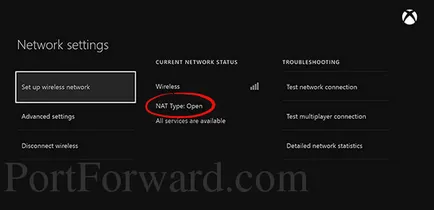 Hogyan lehet aktiválni nat mód és statikus IP-címet az Xbox One