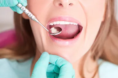 Cum de a trata cariile dentare metode moderne, etape, în cazul în care pentru a merge