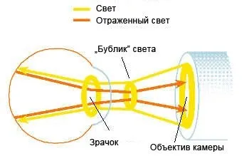 Як фотографують очне дно (диск зорового нерва) Як фотографують очне дно