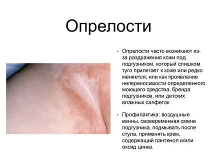 Cum să aibă grijă de un tratament de vara de piele pentru copii de scutec erupții cutanate, de căldură înțepător și dermatita