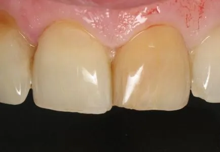 Cazuri clinice portal stomatologic