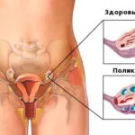 instrucțiuni de utilizare, clomifen preț, recenzii, analogi