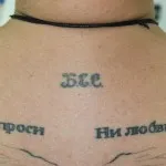 Îndepărtarea cu laser de avantaje și dezavantaje tatuaje