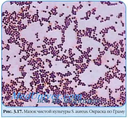 Микробиологична диагноза на S. Aureus