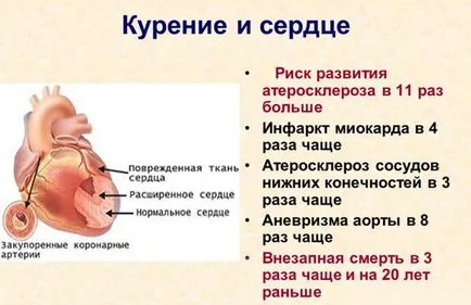 Dohányozhatok szívroham után - az elektronikus cigaretta, hirtelen dobott, stenting