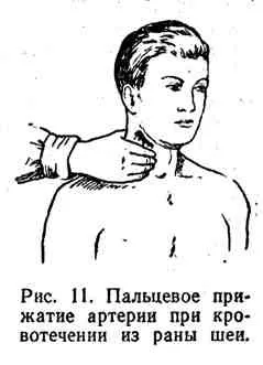 Кровотеча, його види та способи зупинки (лівого шлуночка серця) Кровотеча, його види та способи зупинки