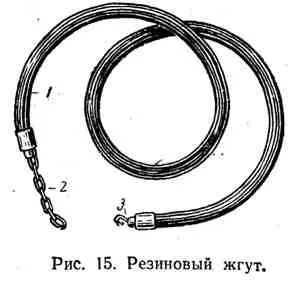 Кровотеча, його види та способи зупинки (лівого шлуночка серця) Кровотеча, його види та способи зупинки