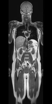 MRI az egész testet (- teljes test -) - ár, árfolyam, dekódolás, előkészítése, ellenjavallatok