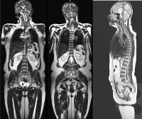 MRI на цялото тяло - цените в Москва намерени 43 цени