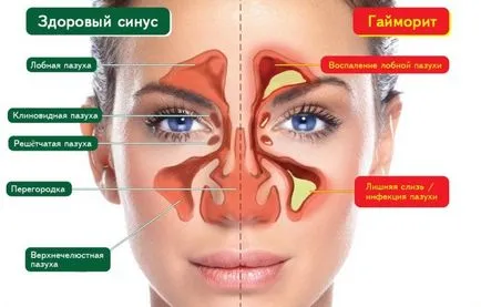 Възможно ли е в синусов носа топло затопляне