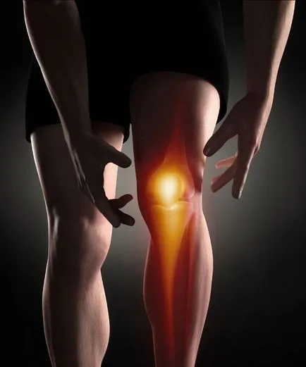 Kneepads a térdízületi osteoarthritis, hogyan kell felvenni a zárolást, a beteg véleménye