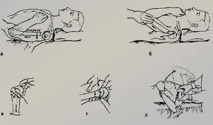 Fracturarea colului chirurgical al humerusului