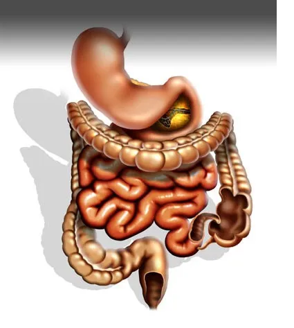 pneumatoză intestinale - tratamentul remedii populare, medicamente