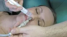 Лікування гаймориту синус-катетером ЯМІК відео, фото, відгуки (ЯМІК) Лікування гаймориту синус-катетером ЯМІК відео, фото, відгуки