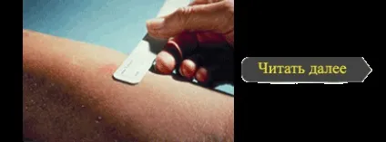 Лабораторна діагностика туберкульозу