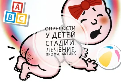 Лікування попрілостей у новонароджених (новонароджених) Лікування попрілостей у новонароджених
