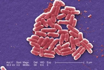 Hasznos és káros baktériumok az emberi - vadon világ