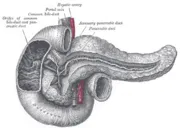 Postcholecystectomical szindróma - egy